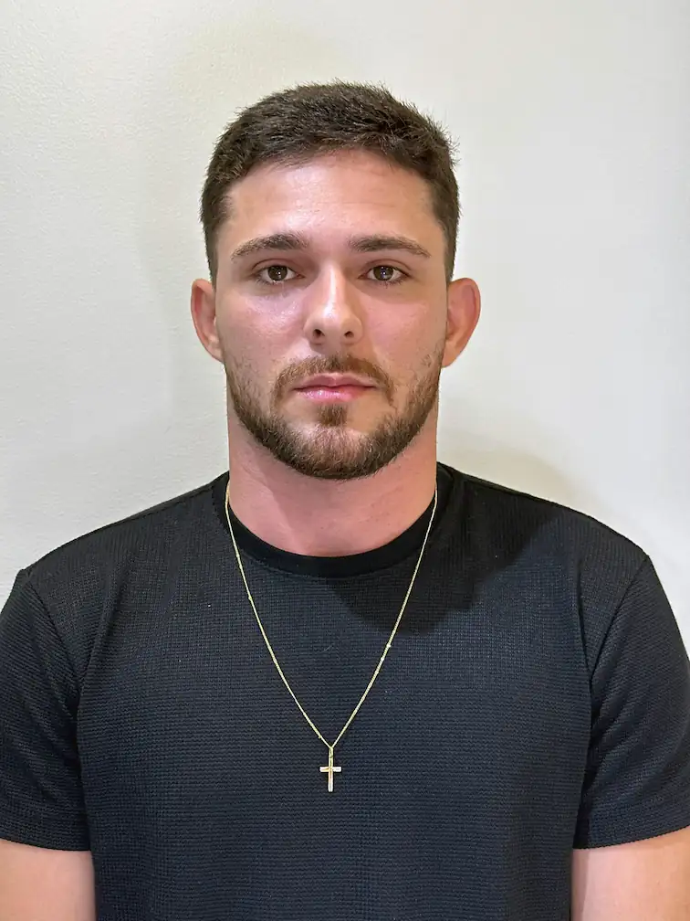 Orelhas proeminentes antes do procedimento - Caso real de correção de orelhas de abano pela Dra. Alexia Lima